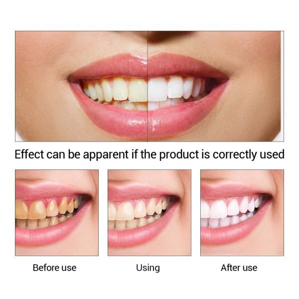 FTEENPLY Tooth Whitening Essence with 10 cotton swabs - Image 4